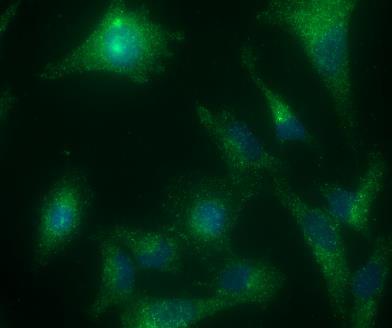 (A) Autophagy was evaluated by immunocytochemistry using rabbit anti-microtubule-associated protein