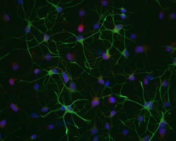 Noteworthy, GFAP, S100B and GLT-1 have been used to identify differentiated astrocytes from ipscs (Kleiderman et al.