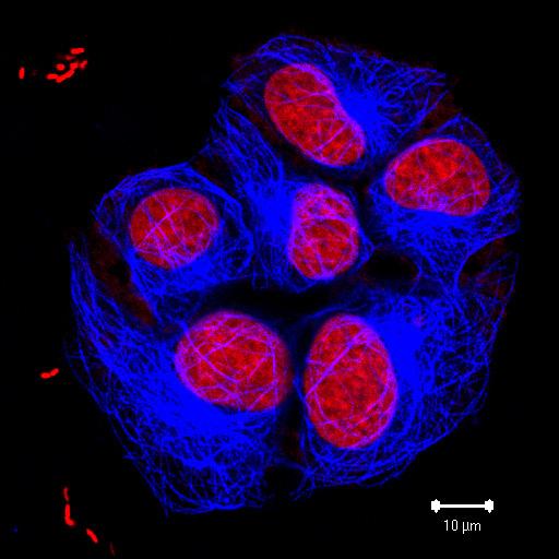 nucleotídeos) Topoisomerase