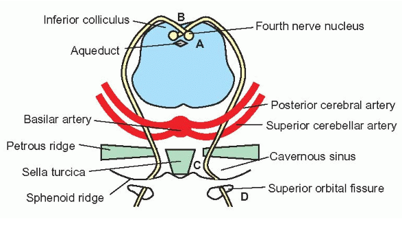4º par craneano - nervo troclear O 4º par craneano é responsável pela inervação do músculo oblíquo superior, tendo este como principal acção a infraducção do olho, principalmente quando este se