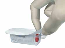4.2 Abertura da embalagem do implante Straumann SLActive 1 Passo 1 Abertura do blister e remoção da ampola Nota O blister assegura