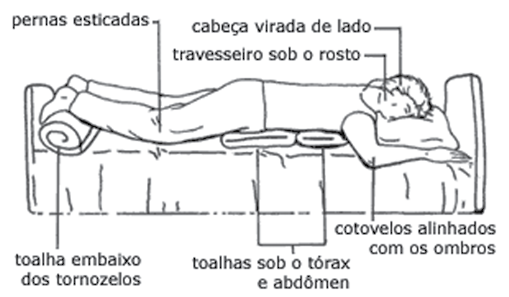 3 Deitada de bruços Deite a pessoa de bruços, vire a cabeça delicadamente para um dos lados acomodando-a com um travesseiro fino ou toalha dobrada.