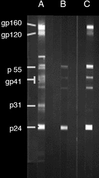 O Teste 2 é um resultado positivo porque mostra que há anticorpos para sete das proteínas do VIH. O Teste 3 é um resultado negativo.