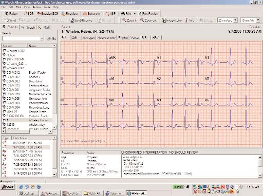 Tenha mais dados em seu poder sem exigir mais do seu tempo Utilize o Software de Estações de Trabalho CardioPerfect da Welch Allyn para gerir os dados dos seus testes electrocardiográficos Todos os