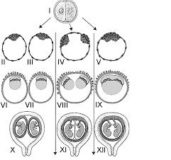 49- (UFV-MG) Observe o esquema abaixo, que representa três exemplos de sequências de etapas embrionárias que podem ocorrer durante o processo de formação de gêmeos.