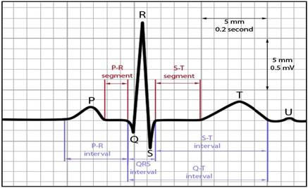 A onda P representa a despolarização atrial, ou seja, ela registra o momento em que acontece a contração atrial.