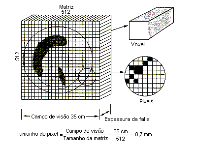 2 - Fundamentos Físicos e Técnicos da Tomografia Computorizada 2.6.5.