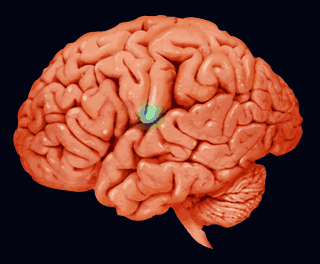 ESPECTROSCOPIA DE PRÓTONS POR RESSONÂNCIA MAGNÉTICA NO DIAGNÓSTICO DO MAL DE ALZHEIMER