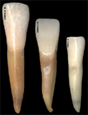 Anatomia Dental Interna Incisivos Inferiores Incisivo Central Inferior