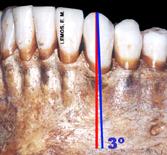 Anatomia Dental Interna