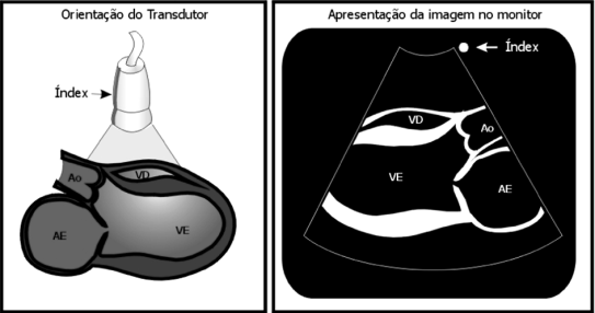 O sinal US é emitido e será refletido e processado até à transformação em imagem.