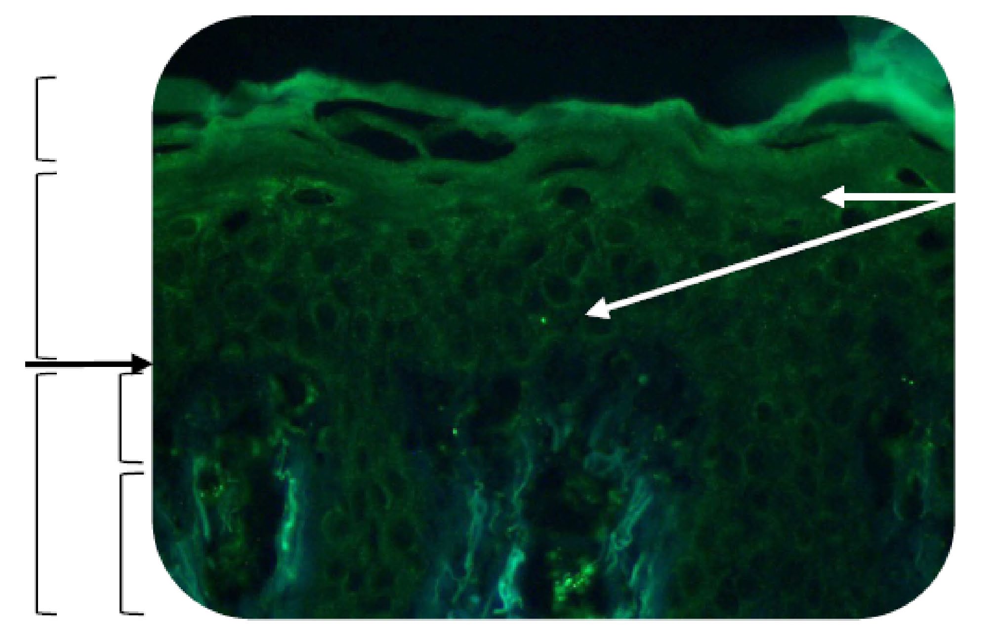 Os núcleos, contrastados com fluorescência vermelha. Imunomarcação de tropoelastina As amostras congeladas recuperadas no D9 foram cortadas em seções 7μm de espessura.