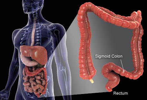 eficácia da intervenção, baseada na identificação do estágio da doença, e (5) uma abordagem economicamente justificável. O câncer colorretal (Intestino grosso cólon e reto) é freqüente em nosso meio.