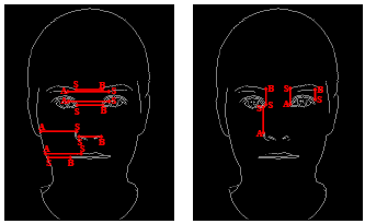 Nas Figuras 10 e 11 são mostrados alguns exemplos de segmentos áureos horizontais e verticais encontrados na face, considerando a razão entre os segmentos AS e SB.