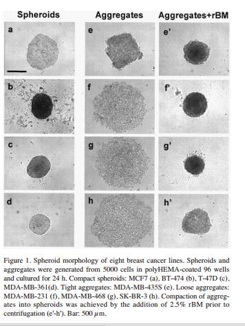 Estudos in vitro Células do derrame pleural derivadas do câncer de