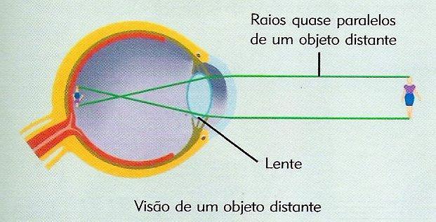 Formação da Imagem A formação da imagem na retina requer 4 processos básicos: 1) Refração dos raios de luz;