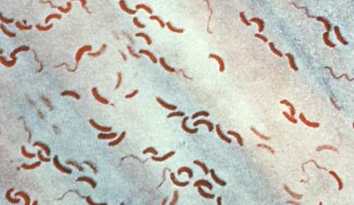 Vibrio