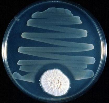 IMPORTÂNCIA DOS FUNGOS MÉDICA ALEXANDER FLEMING (1881 1955) Nasceu em Lochifield em 6 de agosto de 1881 (Reino Unido); 1928 Professor do