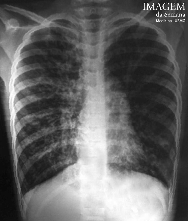 Imagem da Semana: Radiografia e Fotografia Figura 1: Fotografia