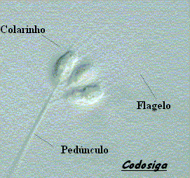 pedúnculo (flagelo usado na captura de alimento); alguns apresentam um
