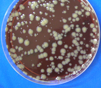RESULTADOS Bactérias, como Pseudomonas aeruginosa, Proteus mirabilis, Staphylococcus aureus, Acinetobacter baumanii e fungos, como Candida