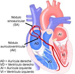 a)taquicardias supraventriculares Origem dos estímulos nos átrios e nódulo A-V.