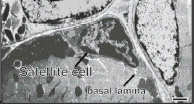 Hipertrofia Células satélites Para que haja hipertrofia, as células satélites precisam