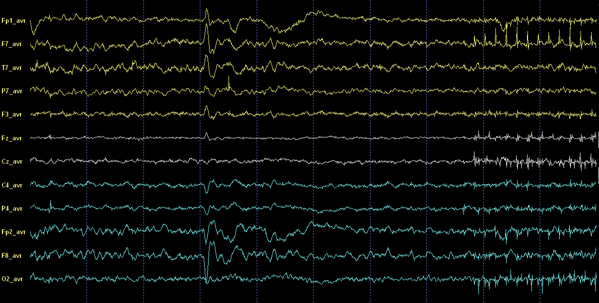 Capítulo 5 Imagem por Ressonância Magnética 5.3.