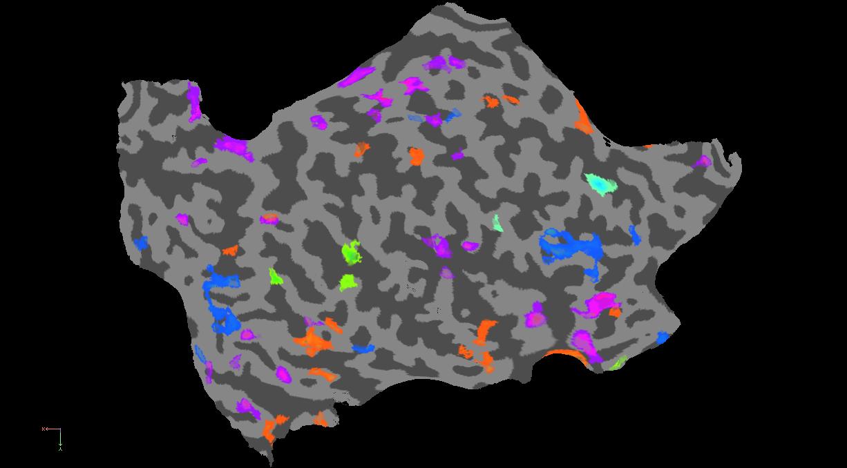 Capítulo 7 Resultados 7.2.4 Paciente 4 - JB Figura 7.