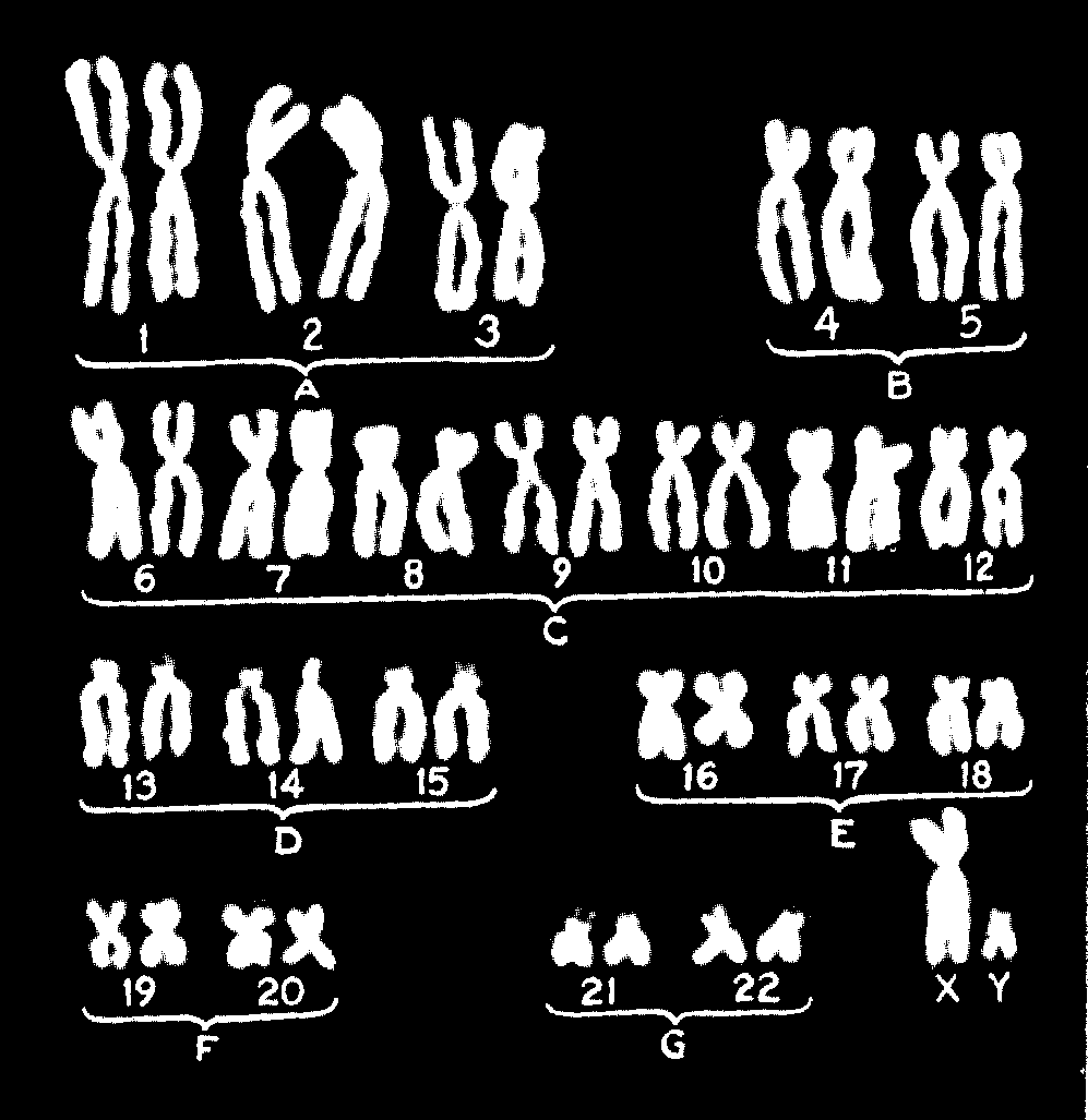 O número e a forma dos cromossomos de uma determinada