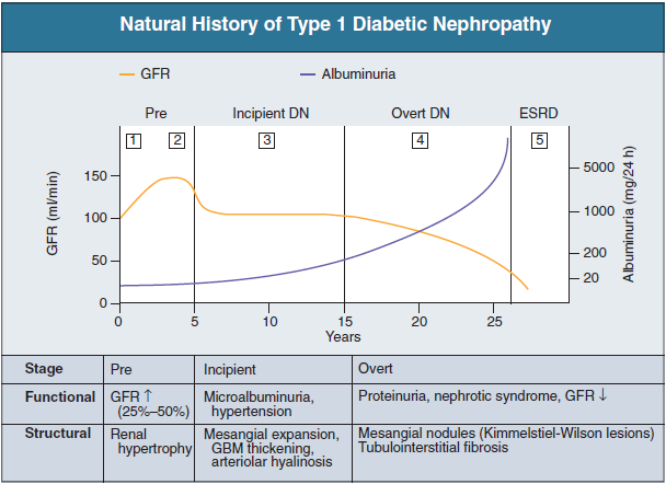 Nefropatia Diabética