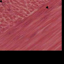 Regeneração do Tecido Muscular Músculo Cardíaco - Não se regenera- tecido conjuntivo (fibroblastos).