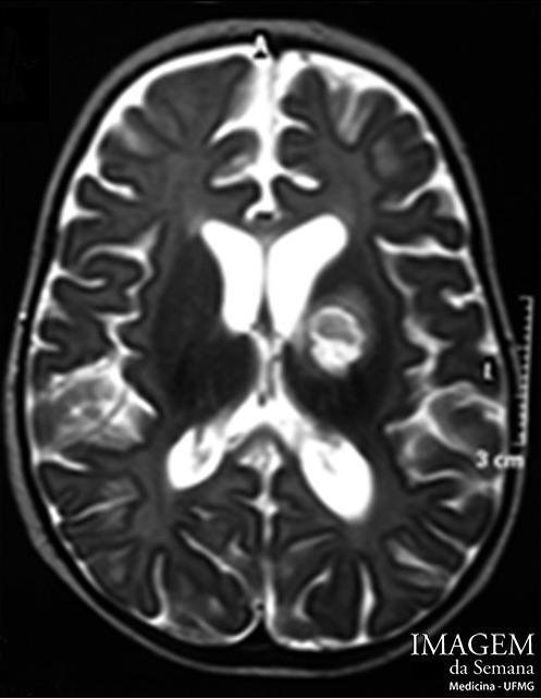 Imagem da Semana: Tomografia computadorizada, Ressonância nuclear magnética Figura 1: Tomografia