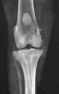 Posicionamento da articulação do joelho em projeção craniocaudal Radiografia de membro pélvico em