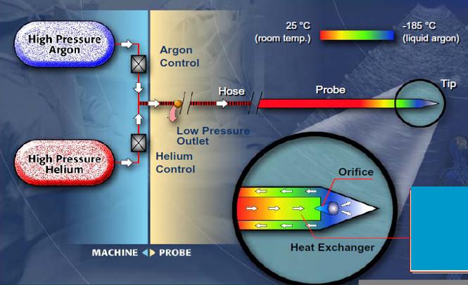 Evolução da Tecnologia 1996 - Argon