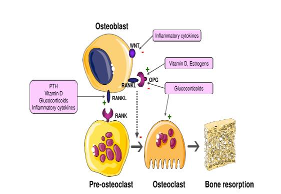 Quando avaliar e como manejar Osteopenia e Osteoporose na DPOC Fernando Lundgren Pontos para pensar Osteopenia e Osteoporose na DPOC doença concomitante? Ocorre em todo paciente com DPOC?