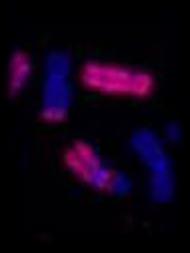 Cromossomas dicêntricos Translocações anéis Micronúcleos Outros biomarcadores: troca entre cromátides irmãs, Comet assay, -H2AX Aberrações