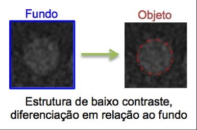 CONTROLE DE QUALIDADE DE SISTEMAS DIGITAIS RAZÃO CONTRASTE RUÍDO É o parâmetro indicado para avaliar a qualidade da imagem em Radiologia Digital; A determinação da CNR