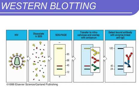 Testes Diagnósticos Western Blot: O soro do paciente, onde se faz a pesquisa dos anticorpos contra o HIV, é colocado em contato com uma membrana que contém