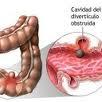 EXCESSOS Triglicerídeos; LDL; Colesterol; Estados Unidos.