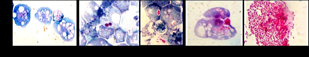 Patogénese: Ciclo de vida da Legionella nas amibas (hospedeiro natural) e nos macrófagos humanos (hospedeiro acidental) Amibas