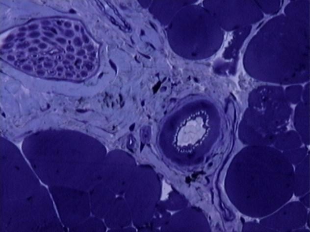 Regulação do fluxo para os tecidos: Auto-regulação Mecanismos neurogênicos