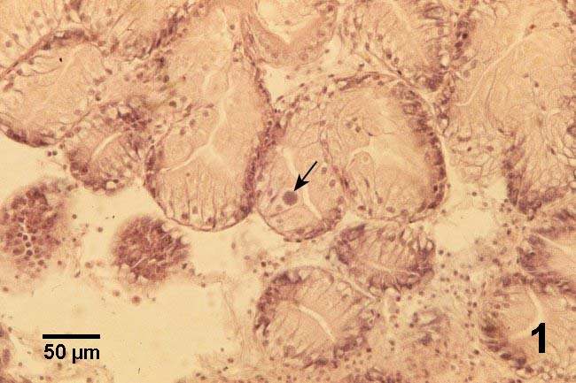 DOENÇA A EPITELIOCÍSTICA 1. Glândula digestiva de Tapes philippinarum com uma colônia de organismos Rickettsia-like ou Chlamydia-like organisms (flecha) numa célula epitelial.