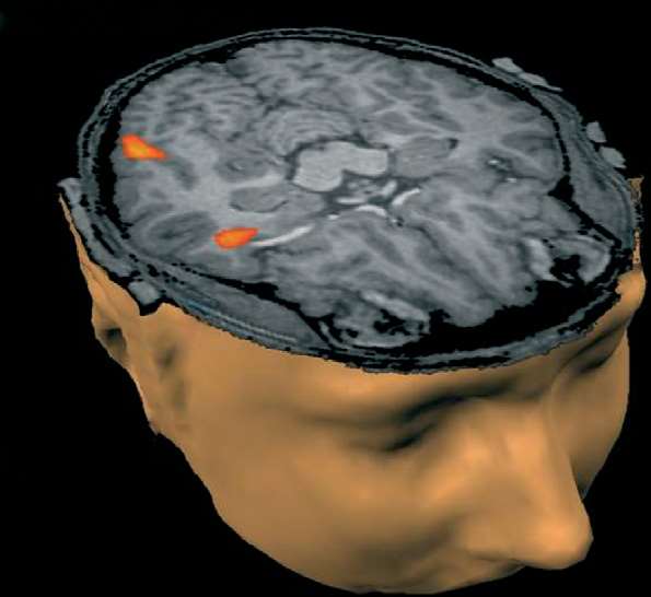 Aspectos neurobiológicos do TEA Relação da amígdala com as áreas responsáveis