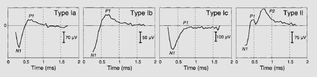 35 Figura 9. Formatos de ondas N1, P1 e P2 no ECAP. Lai e Dillier (33).