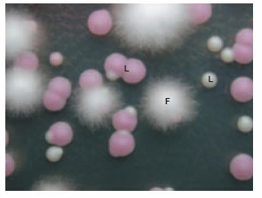 Super Reino Eucaryota Protozoários Protozoa: protozoários que vivem no intestino de animais, não possuindo algumas organelas como mitocôndrias Ex: Giardia Protistas: