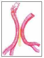 3.2 Meiose I (Prófase I) 3.2.a) Leptoteno: Início da condensação cromossômica. 3.2.b) Zigóteno: Homólogos (um de cada genitor) lado a lado; Sinapse (ou pareamento); Complexo sinaptonêmico; Cada par homólogo: cromossomo bivalente.