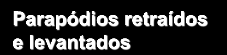 Parapódios estendidos em contato com o substrato Parapódios retraídos e levantados Ação dos parapódios e musculatura