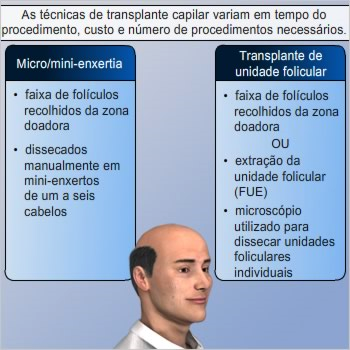 Que procedimento devo usar?