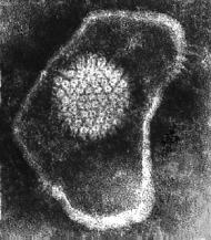 Microscopia eletrônica Observa a morfologia do vírus Baixa sensibilidade: 10 6 10 8 partículas virais/ml Amostras para diagnóstico: - cutâneas: